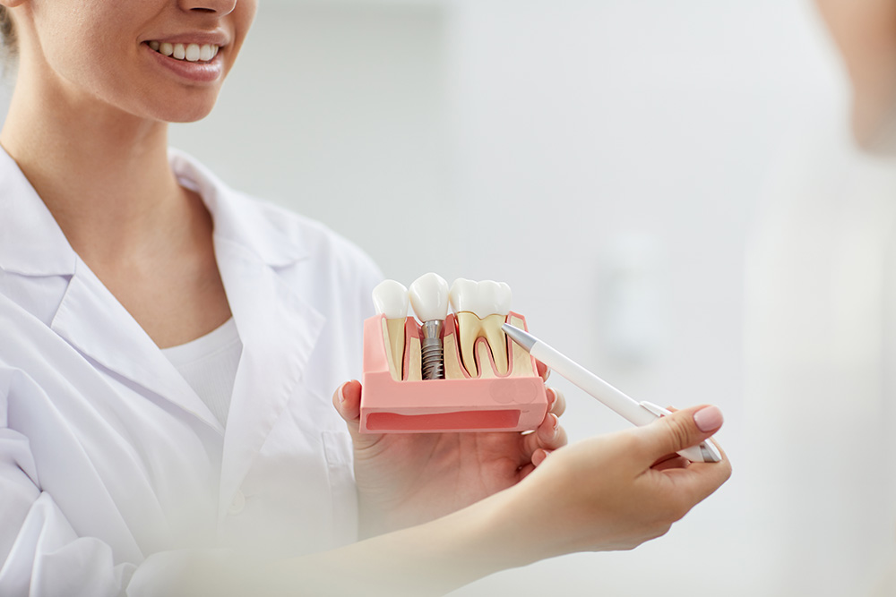 implante dental - Dentista en Lucena  | Pomes Dental ®