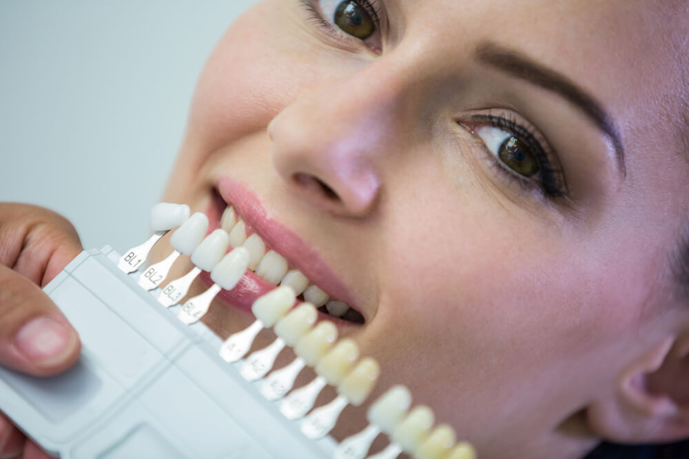 Prinicpales causas y prevención de los dientes amarillos